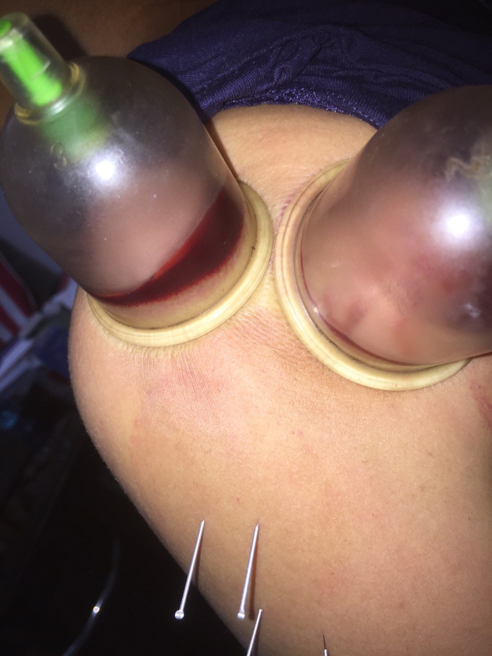 Physiotherapy Equipment