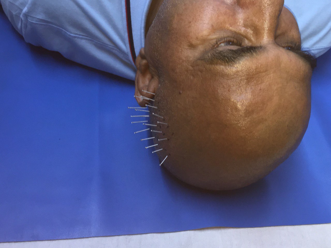 Treatment Bed