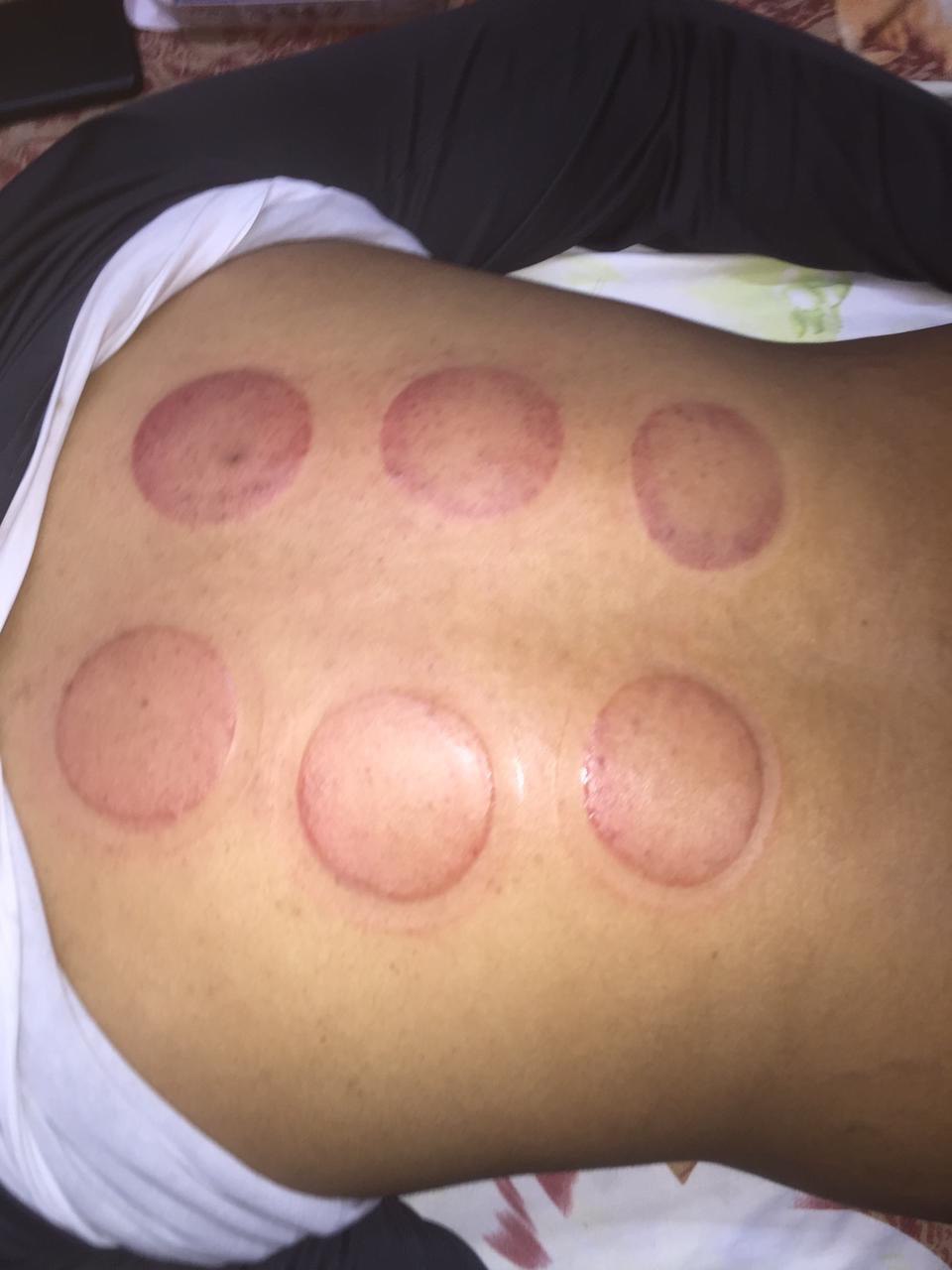 Treatment Bed